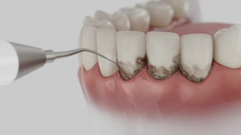 Reliable Root Canal Treatment contractor in Buncombe County County, NC by Dentist Open Now